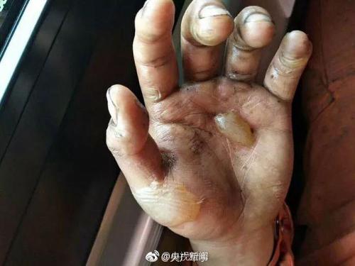 国内新闻3名消防员卢亮,万京燕,孙雨豪 在抬送被困工人过程中 被突发